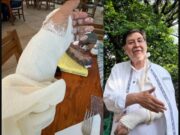 Fernández Noroña sufre fractura en muñeca tras accidente en Tepoztlán El legislador Fernández Noroña anuncia suspensión temporal de videocharlas por fractura en muñeca tras caída en Tepoztlán.