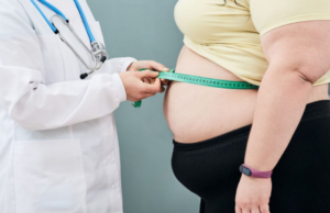 Obesidad: la pandemia silenciosa que avanza sin freno en el mundo