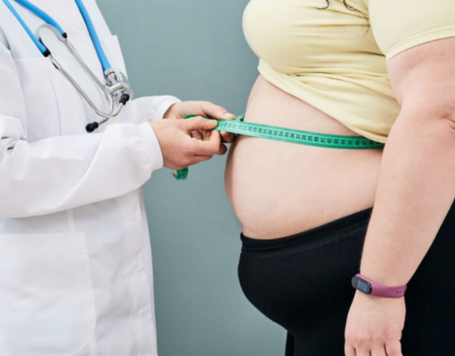 Obesidad: la pandemia silenciosa que avanza sin freno en el mundo