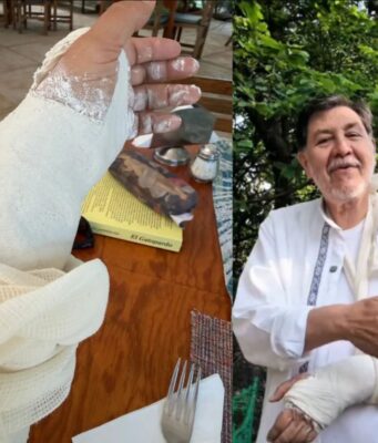 Fernández Noroña sufre fractura en muñeca tras accidente en Tepoztlán El legislador Fernández Noroña anuncia suspensión temporal de videocharlas por fractura en muñeca tras caída en Tepoztlán.