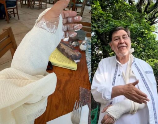 Fernández Noroña sufre fractura en muñeca tras accidente en Tepoztlán El legislador Fernández Noroña anuncia suspensión temporal de videocharlas por fractura en muñeca tras caída en Tepoztlán.