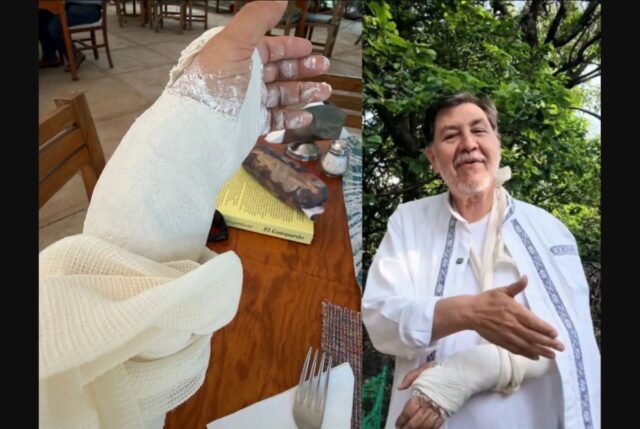 fernandez-norona-fractura-muneca-tepoztlan El legislador Fernández Noroña anuncia suspensión temporal de videocharlas por fractura en muñeca tras caída en Tepoztlán.